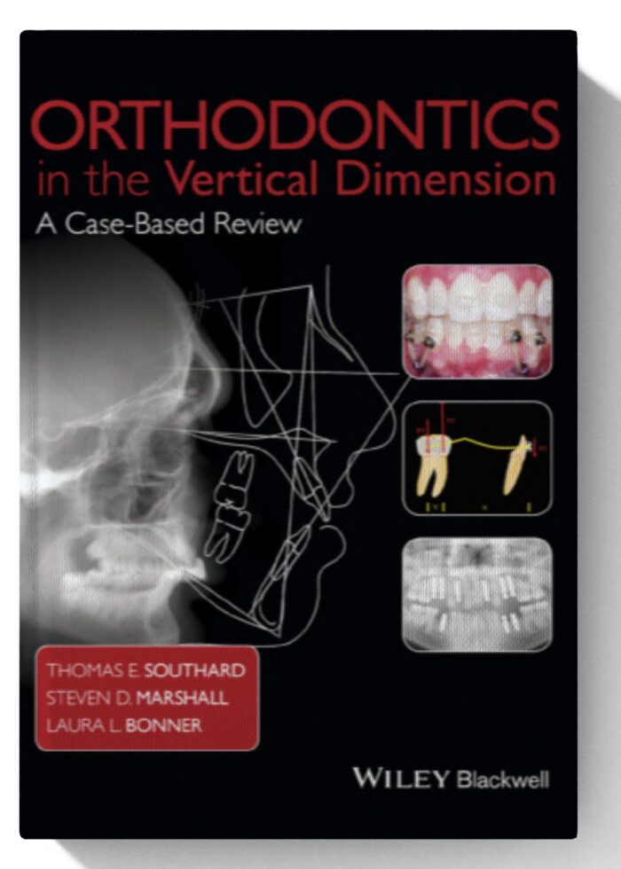 Orthodontics in the Vertical Dimension: A Case-Based Review 1st Edition