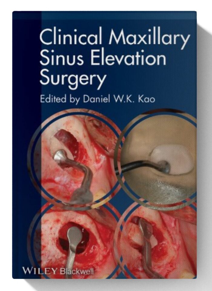 Clinical Maxillary Sinus Elevation Surgery 1st Edition