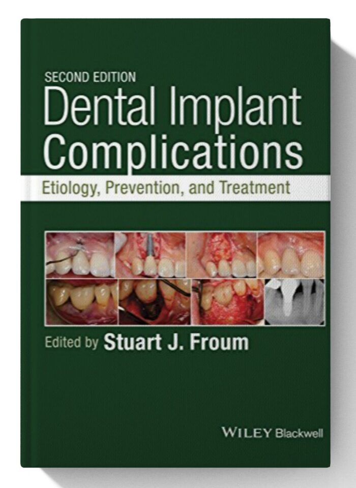 Dental Implant Complications: Etiology, Prevention, and Treatment 2nd Edition